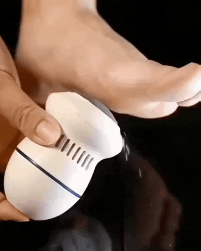 CallusFree™  (Removedor de callos recargable)