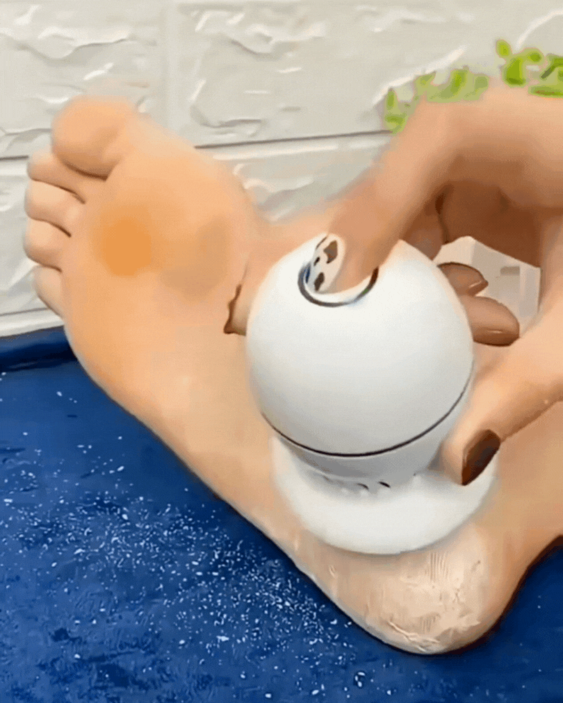 CallusFree™  (Removedor de callos recargable)